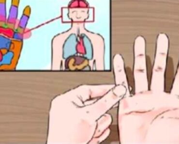 Titta på dina fingrar – gör dom DETTA så har du diabetes!