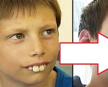 Pojken blev mobbad för sina tänder varje dag men familjen hade inte råd att låta honom gå till tandläkaren. Men se vad som hände DÅ!
