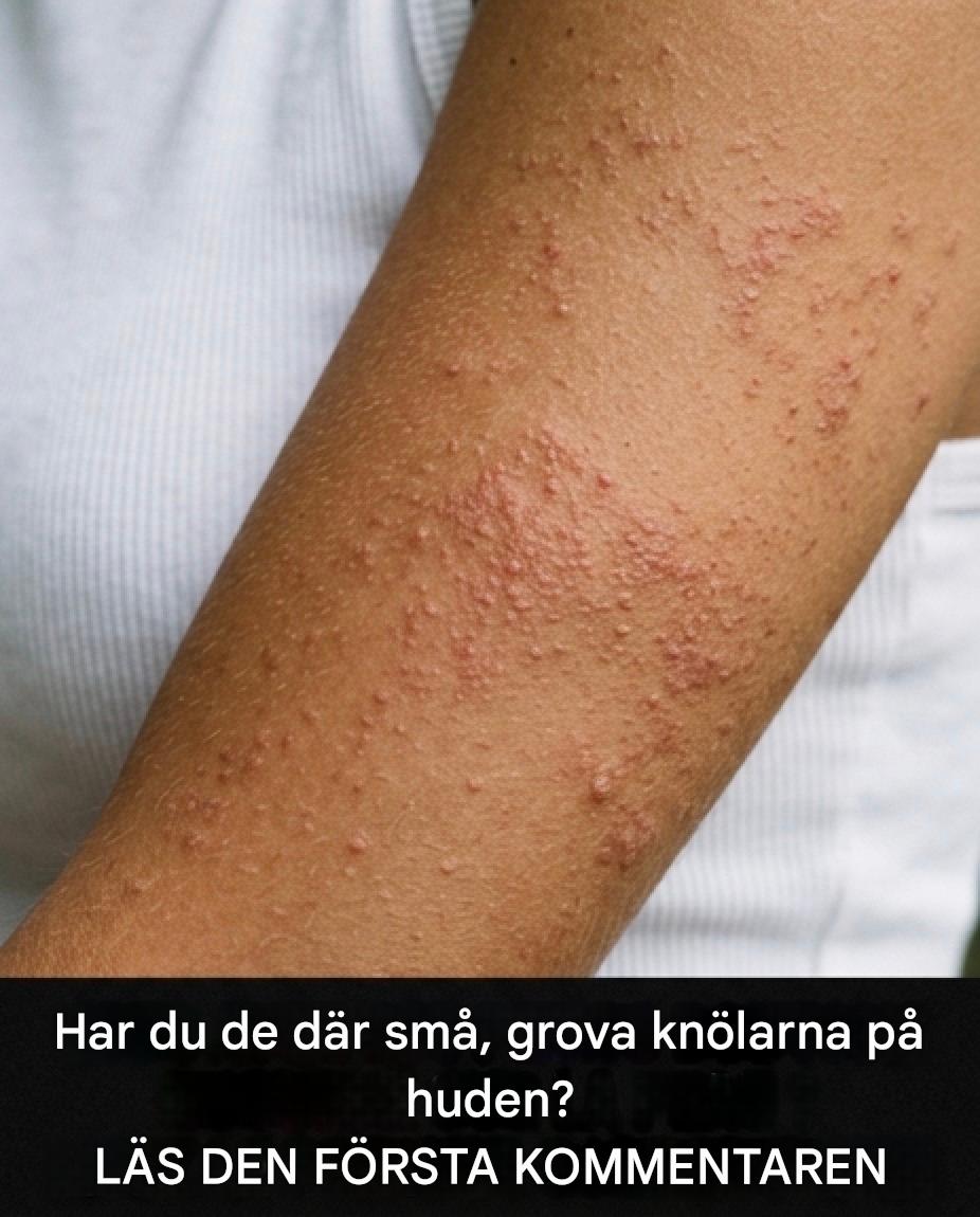 Varför uppstår grova fläckar på huden och hur kan deras utseende förbättras?